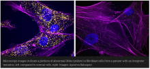 Fluorescence microscopy image of cells 